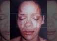 Agression de Rihanna : une policière licenciée !