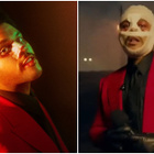 The Weeknd : pourquoi a-t-il des bandages ?