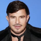 Vincent Niclo répond aux critiques sur son visage