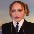 Madonna répond aux critiques sur son visage