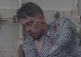 Lartiste raconte son agression dans son clip