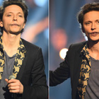 Raphaël défiguré aux Victoires de la Musique