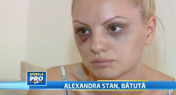 Alexandra Stan battue par son manager