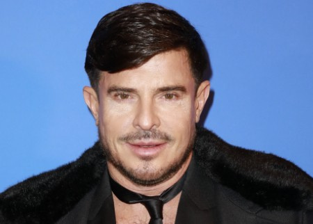 Vincent Niclo répond aux critiques sur son visage