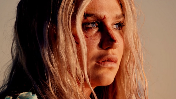 Kesha se relève dans le clip "Praying"