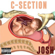 C-section - Single