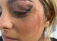 Bebe Rexha attaquée au visage, la vidéo choc
